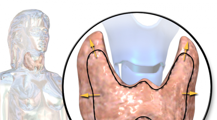 Nadczynność tarczycy