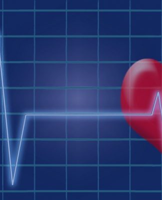 Holter EKG Holter EKG