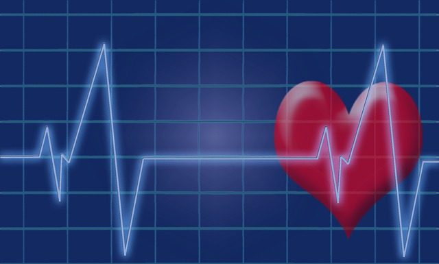 Holter EKG Holter EKG