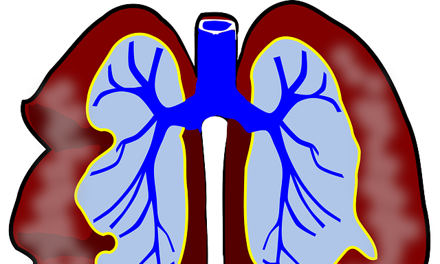 Zapalenie płuc