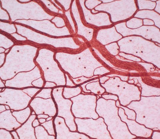 Laserowe zamykanie naczynek - czy przyniesie rezultaty?