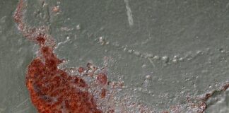 Jak wygląda wysokie podbicie?